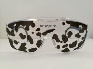 Diabetische Retinopathie GeroQuiz